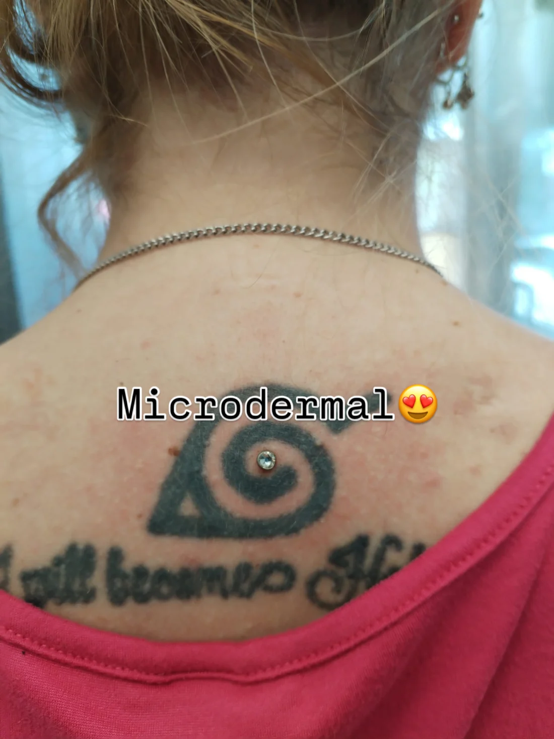 Microdermal Schiena - Elena Parvu