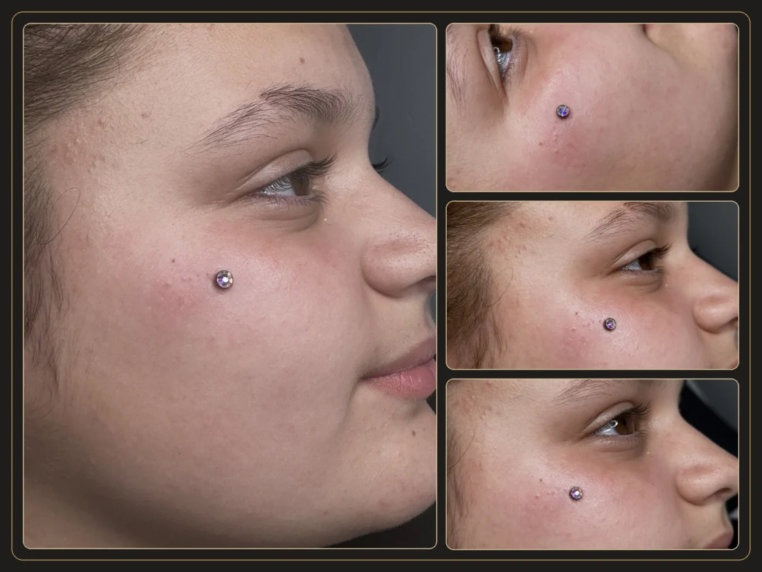 Microdermal Piercing - Elena Parvu