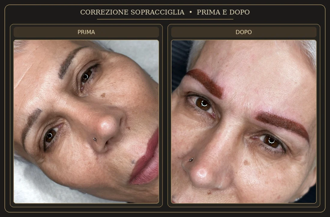 Correzione Sopracciglia – Prima e Dopo - Elena Parvu