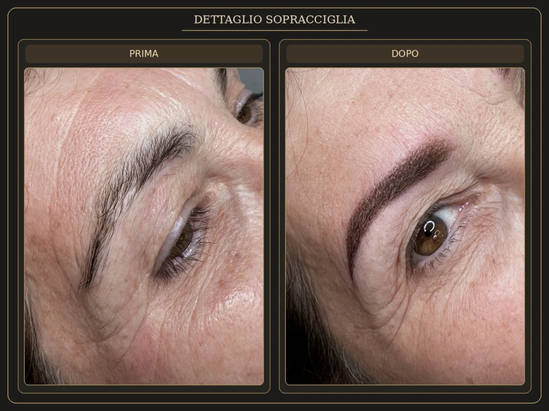 Dettaglio Sopracciglia – Prima e Dopo - Elena Parvu