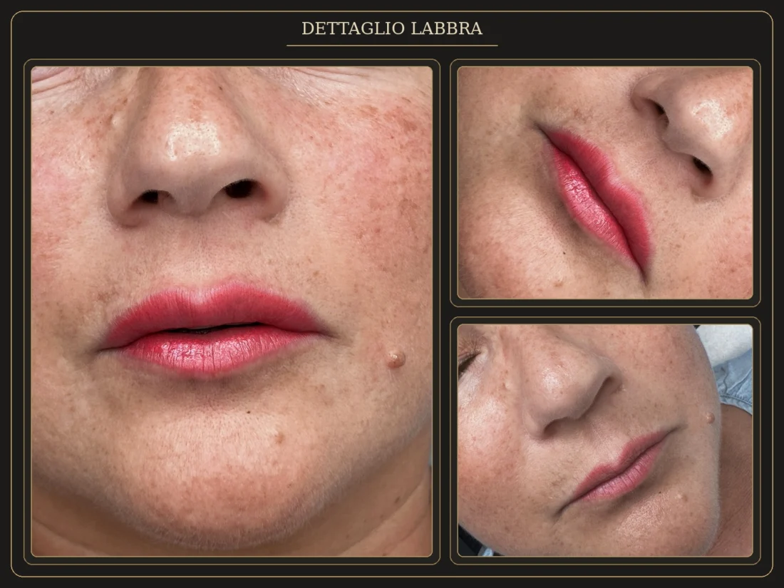 PMU Labbra – Dettagli del Trattamento - Elena Parvu
