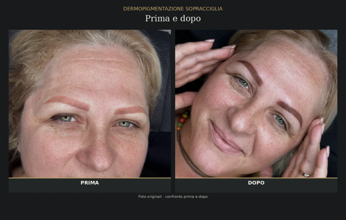 Dermopigmentazione Sopracciglia - Prima e Dopo - Elena Parvu