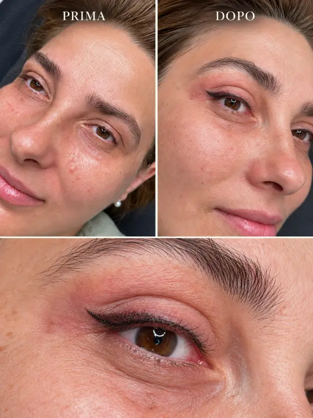 Eyeliner Permanente – Prima e Dopo - Elena Parvu